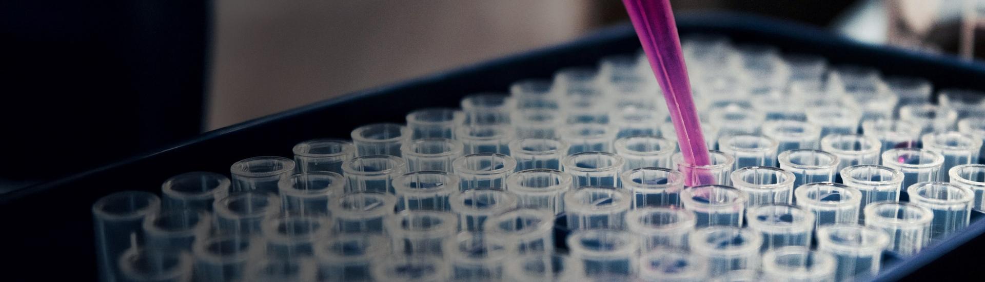 Interim Management Life Sciences und Medizintechnik: Das Bild zeigt eine Pipette, aus der Flüssigkeit in Reagenzgläser gefüllt wird.